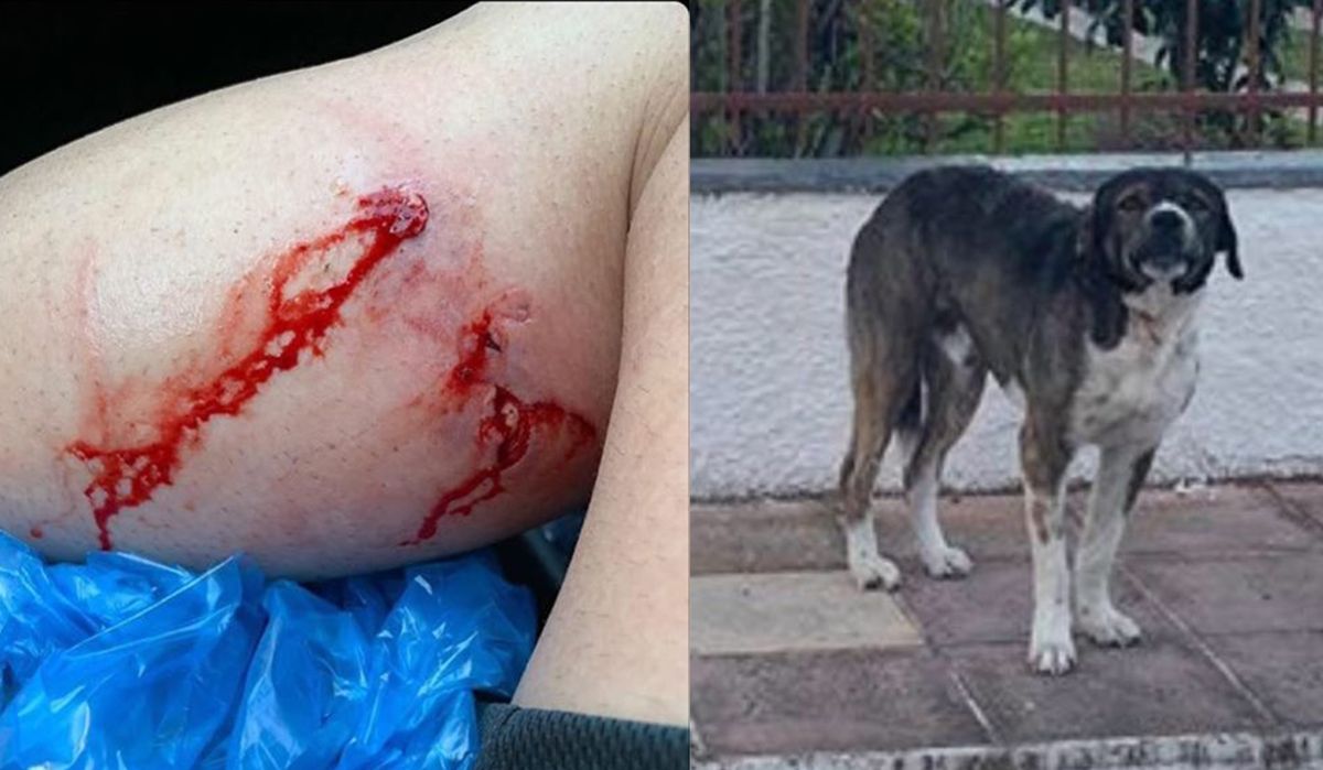Άγρια επίθεση σκύλου σε 21χρονο (Σκληρές εικόνες)
